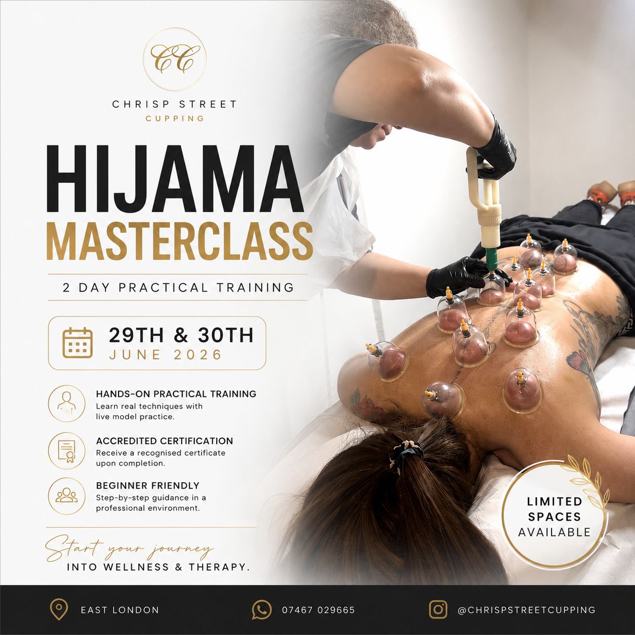 Hijama Masterclass 2 Day Practical Training East London
