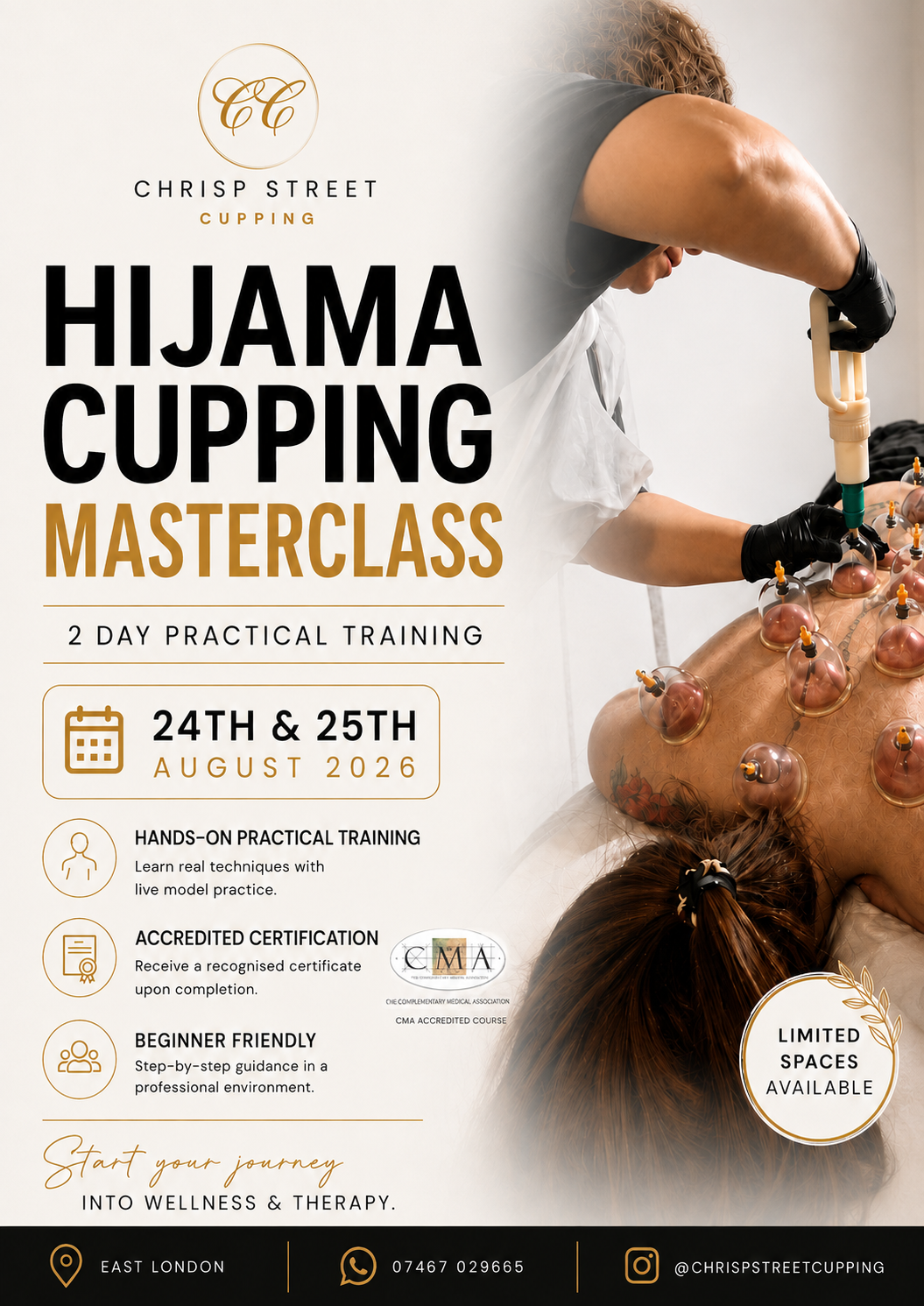 Hijama Wet Cupping Masterclass London 24th and 25th August 2026